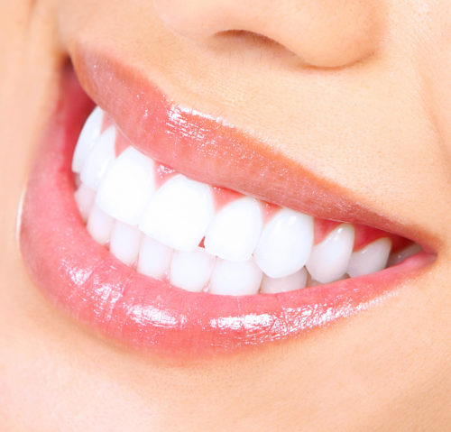 Quelques trucs pour conserver de belles dents blanches